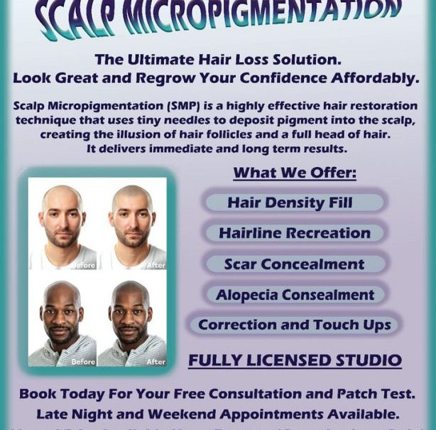 Scalp Micropigmentation - Affordable Hair Loss Solution - SMP